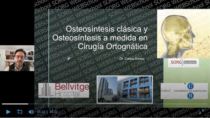 Osteosíntesis clásica y osteosíntesis a medida en Cirugía Ortognática  | Language: Spanish