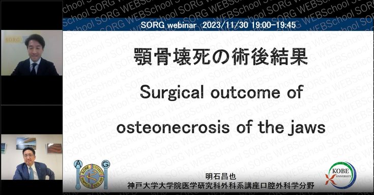 顎骨壊死に関するUP DATE | The UPDATE about Osteonecrosis