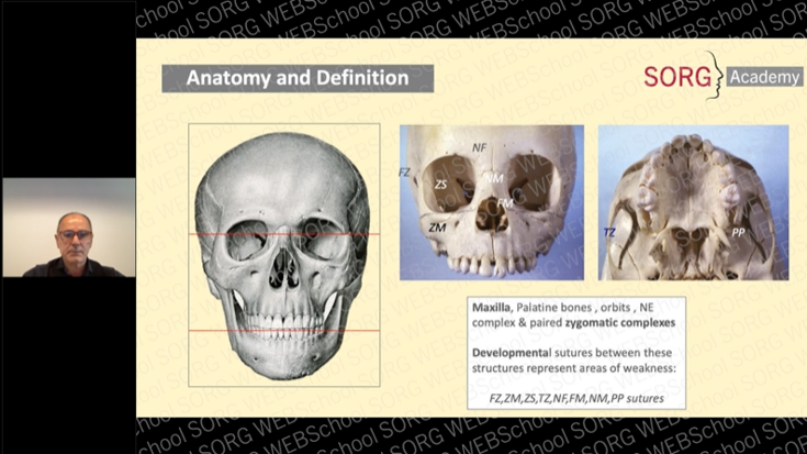 Management of Midface Trauma